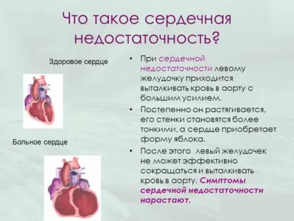 Дієта при серцевій недостатності на кожен день - харчування, зняття набряків, стіл №10
