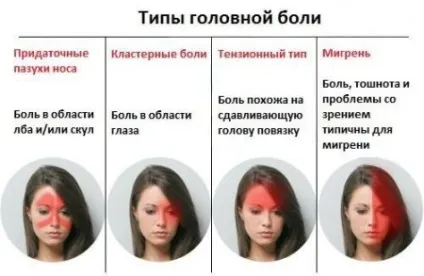 Види головного болю, причини і лікування (причини) Види головного болю, причини і лікування