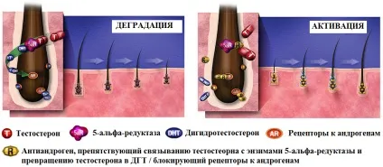 Випадання волосся у чоловіків у молодому віці причини і лікування облисіння у чоловіків (випадання) Випадання волосся у чоловіків у молодому віці причини і лікування облисіння у чоловіків