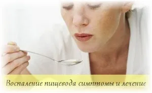 Запалення стравоходу причини, симптоми і лікування (лікування) Запалення стравоходу причини, симптоми і лікування