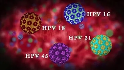 ВПЛ 16 типу у жінок - лікування, симптоми і діагностика (раку шийки матки) ВПЛ 16 типу у жінок - лікування, симптоми і діагностика