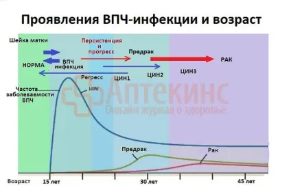 ВПЛ 16 типу у жінок - лікування, симптоми і діагностика (типу) ВПЛ 16 типу у жінок - лікування, симптоми і діагностика