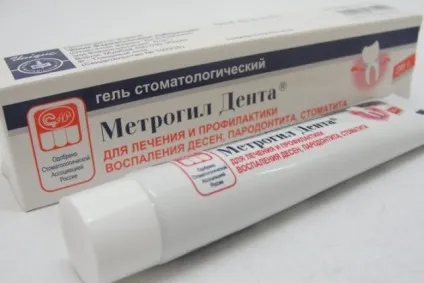 Запалилася ясна під коронкою причини і лікування (лікування) Запалилася ясна під коронкою причини і лікування