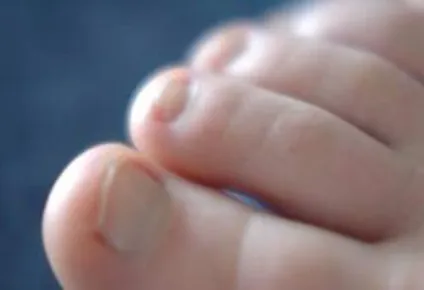 Другий палець вашої ноги довші, ніж всі інші дізнайтеся, що це значить! (Ноги) Другий палець вашої ноги довші, ніж всі інші дізнайтеся, що це значить!