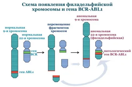 Хронічний мієлолейкоз - особливості даного виду раку крові, симптоми і правильна діагностика, (особливо) Хронічний мієлолейкоз - особливості даного виду раку крові, симптоми і правильна діагностика,