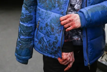 Вибух в Харкові що відомо кримінал силові структури (кримінал) Вибух в Харкові що відомо кримінал силові структури