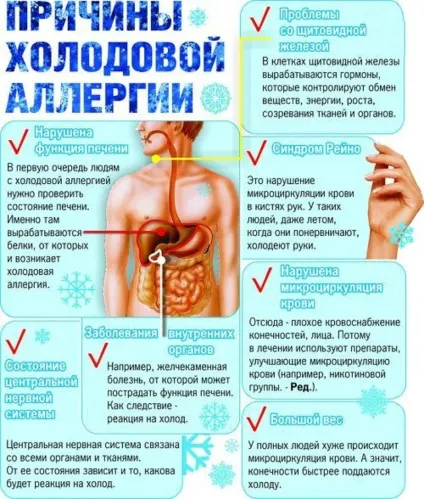 Холодовий дерматит на руках - лікування і симптоми (дерматит) Холодовий дерматит на руках - лікування і симптоми