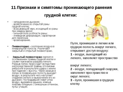 Закритий пневмоторакс симптоми, лікування (симптоми) Закритий пневмоторакс симптоми, лікування
