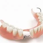 Зубний протез на гачках