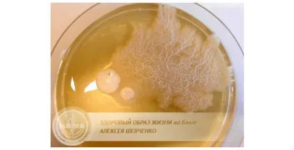 Чим лікувати кашель при всьому його різноманітті (кашель) Чим лікувати кашель при всьому його різноманітті