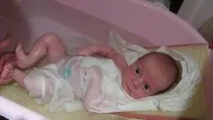 Що таке пітниця - закупорка потових залоз у немовлят - захворювання (висипання шкірні) Що таке пітниця - закупорка потових залоз у немовлят - захворювання