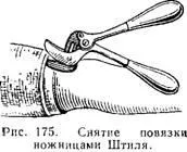 Гіпсова пов'язка - хірургія (пов'язка) Гіпсова пов'язка - хірургія