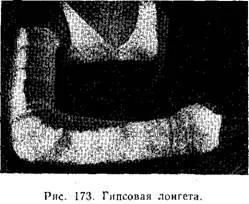 Гіпсова пов'язка - хірургія (щоб) Гіпсова пов'язка - хірургія