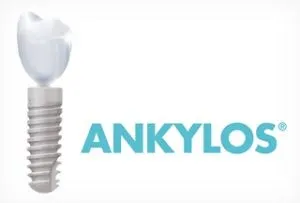 Німецькі імпланти ankylos (анкілоз) види, особливості, відгуки, ціни (ankylos імпланти) Німецькі імпланти ankylos (анкілоз) види, особливості, відгуки, ціни