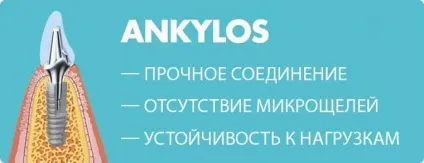 Німецькі імпланти ankylos (анкілоз) види, особливості, відгуки, ціни (анкілоз імпланти офіційний сайт) Німецькі імпланти ankylos (анкілоз) види, особливості, відгуки, ціни