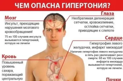 Гіпертонія - причини високого тиску, симптоми, лікування
