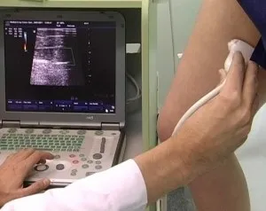 Доплерографія судин нижніх кінцівок