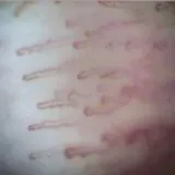 Капіляроскопія як метод діагностики - скальпель - медичний інформаційно-освітній портал (капіляроскопія) Капіляроскопія як метод діагностики - скальпель - медичний інформаційно-освітній портал