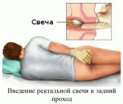 Картопляні свічки від геморою - як робити і відгуки (геморою) Картопляні свічки від геморою - як робити і відгуки