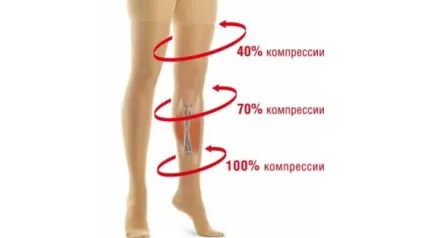 Компресійну білизну при варикозі вибираємо найкраще!