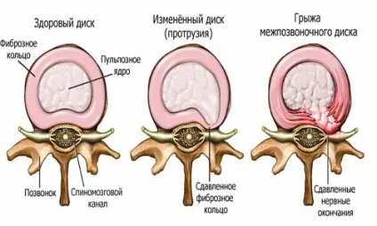 Ліжко Серагем (ceragem, масажна) master - моделі, протипоказання (master) Ліжко Серагем (ceragem, масажна) master - моделі, протипоказання