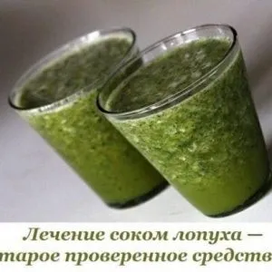 Лікування міоми матки великих розмірів без операції народними засобами (міоми) Лікування міоми матки великих розмірів без операції народними засобами