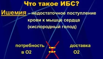 Лікування інфаркту міокарда і терапія (міокарда) Лікування інфаркту міокарда і терапія