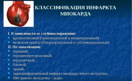 Лікування інфаркту міокарда і терапія (інфаркту) Лікування інфаркту міокарда і терапія