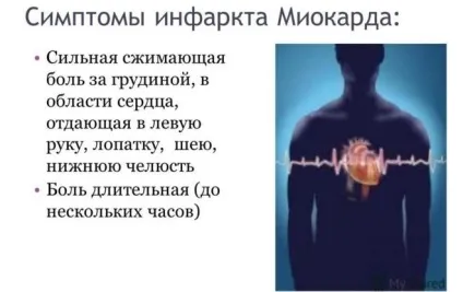 Лікування інфаркту міокарда і терапія (міокарда) Лікування інфаркту міокарда і терапія