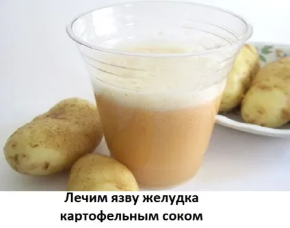 Лікування картопляним соком виразки шлунка, сайт про методи лікування докторів Неумивакіна, Болотова, (лікування болиголов) Лікування картопляним соком виразки шлунка, сайт про методи лікування докторів Неумивакіна, Болотова,