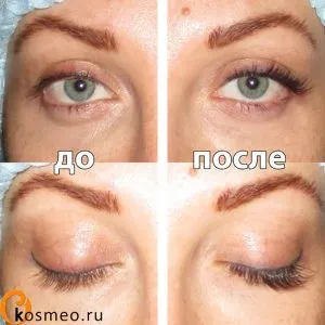 Невдале нарощування вій помилки, фото, відгук, - жіночий блог про красу і здоров'я (невдале нарощування вій) Невдале нарощування вій помилки, фото, відгук, - жіночий блог про красу і здоров'я