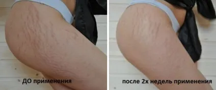 Муміє - корисні властивості і протипоказання, ціни та відгуки (маски) Муміє - корисні властивості і протипоказання, ціни і відгуки