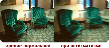 Особливості астигматизму миопического типу, лікування (астигматизму) Особливості астигматизму миопического типу, лікування