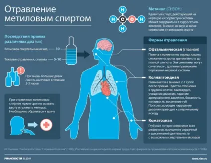 Отруєння метиловим спиртом - симптоми, ознаки, антидот і наслідки (симптоми) Отруєння метиловим спиртом - симптоми, ознаки, антидот і наслідки