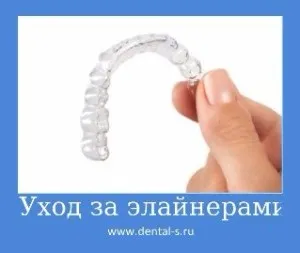 Елайнери Инвизилайн (invisalign) ціна на капи Київ (Инвизилайн Київ) Елайнери Инвизилайн (invisalign) ціна на капи Київ