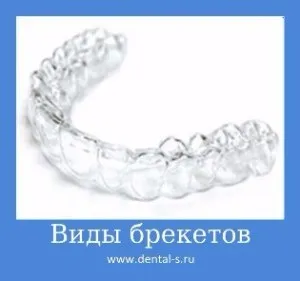 Елайнери Инвизилайн (invisalign) ціна на капи Київ (москва) Елайнери Инвизилайн (invisalign) ціна на капи Київ