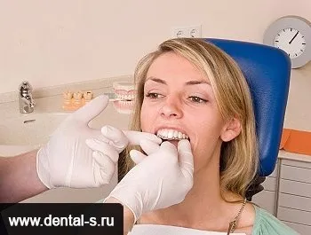 Елайнери Инвизилайн (invisalign) ціна на капи Київ (Инвизилайн) Елайнери Инвизилайн (invisalign) ціна на капи Київ
