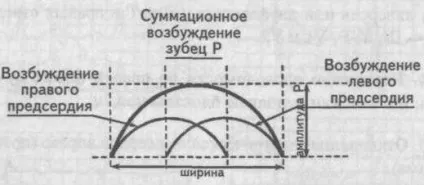 Електрокардіографічні ознаки гіпертрофії міокарда - кардіолог - сайт про захворювання серця і