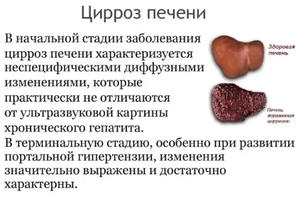 Чому відмовляють ноги у алкоголіків (чому) Чому відмовляють ноги у алкоголіків