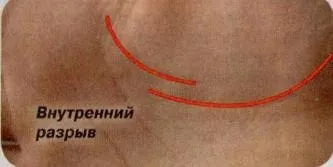 Переривання лінії життя (Cleaner вакуумний очищувач) Переривання лінії життя