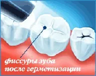 Роль профілактики в дитячій стоматології (роль) Роль профілактики в дитячій стоматології