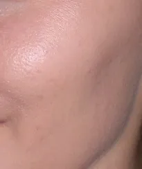 Тональний крем clinique even better makeup spf 15 - відгуки, фото і ціна (clinique) Тональний крем clinique even better makeup spf 15 - відгуки, фото і ціна
