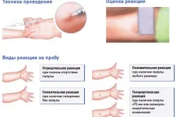 Температура після проби манту у дитини, причини (після) Температура після проби манту у дитини, причини
