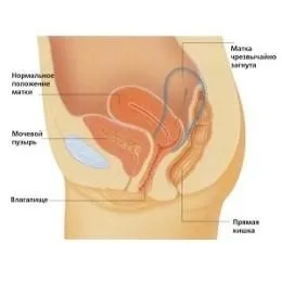 Вакуум після пологів, аспірація, чистка матки метод зберегти здоров'я (чистка) Вакуум після пологів, аспірація, чистка матки метод зберегти здоров'я
