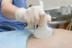 Фіброміома і міома в чому різниця (лікування міоми) Фіброміома і міома в чому різниця