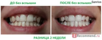 Зубний порошок фітокосметики відбілюючий - «чи можна відбілити зуби відбілюючий зубним порошком мій (відбілити) Зубний порошок фітокосметики відбілюючий - «чи можна відбілити зуби відбілюючий зубним порошком мій