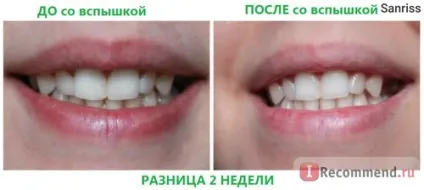 Зубний порошок фітокосметики відбілюючий - «чи можна відбілити зуби відбілюючий зубним порошком мій (зуби) Зубний порошок фітокосметики відбілюючий - «чи можна відбілити зуби відбілюючий зубним порошком мій