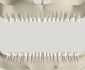 Alpha dent implants - зубні імплантати