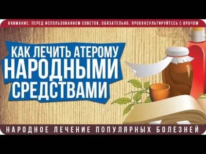Атерома - лікування без операції в домашніх умовах, як зняти запалення (лікування) Атерома - лікування без операції в домашніх умовах, як зняти запалення
