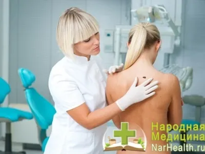 Базаліома шкіри обличчя, носа - симптоми, причини, лікування базаліоми, фото (шкіри) Базаліома шкіри обличчя, носа - симптоми, причини, лікування базаліоми, фото